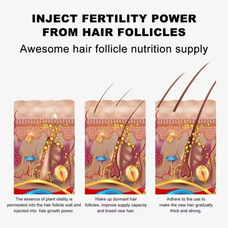 Eyebrow Growth Serum Eyelash H - Hair Growth Serum Oil recension och pris