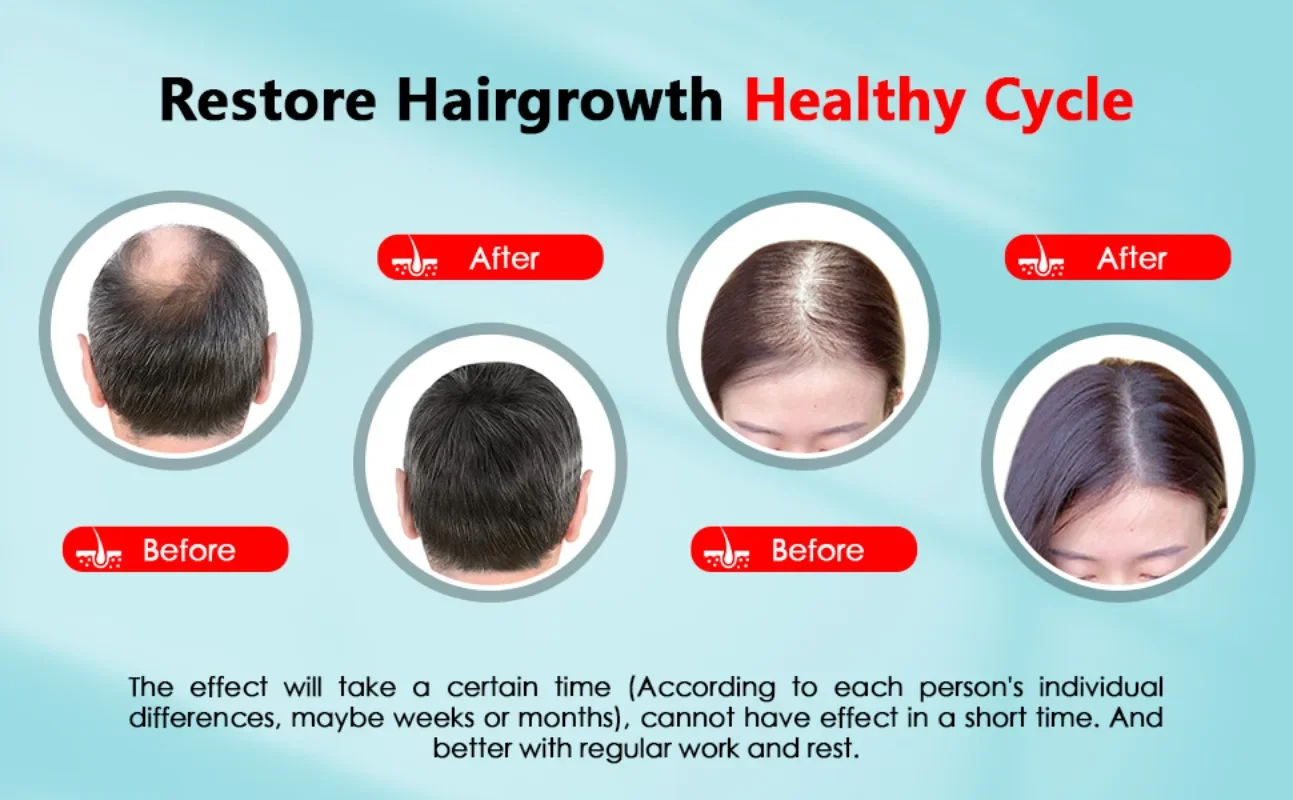 Hair Growth Cap Rechargeable 2 - Hair Care With Protein recension och pris