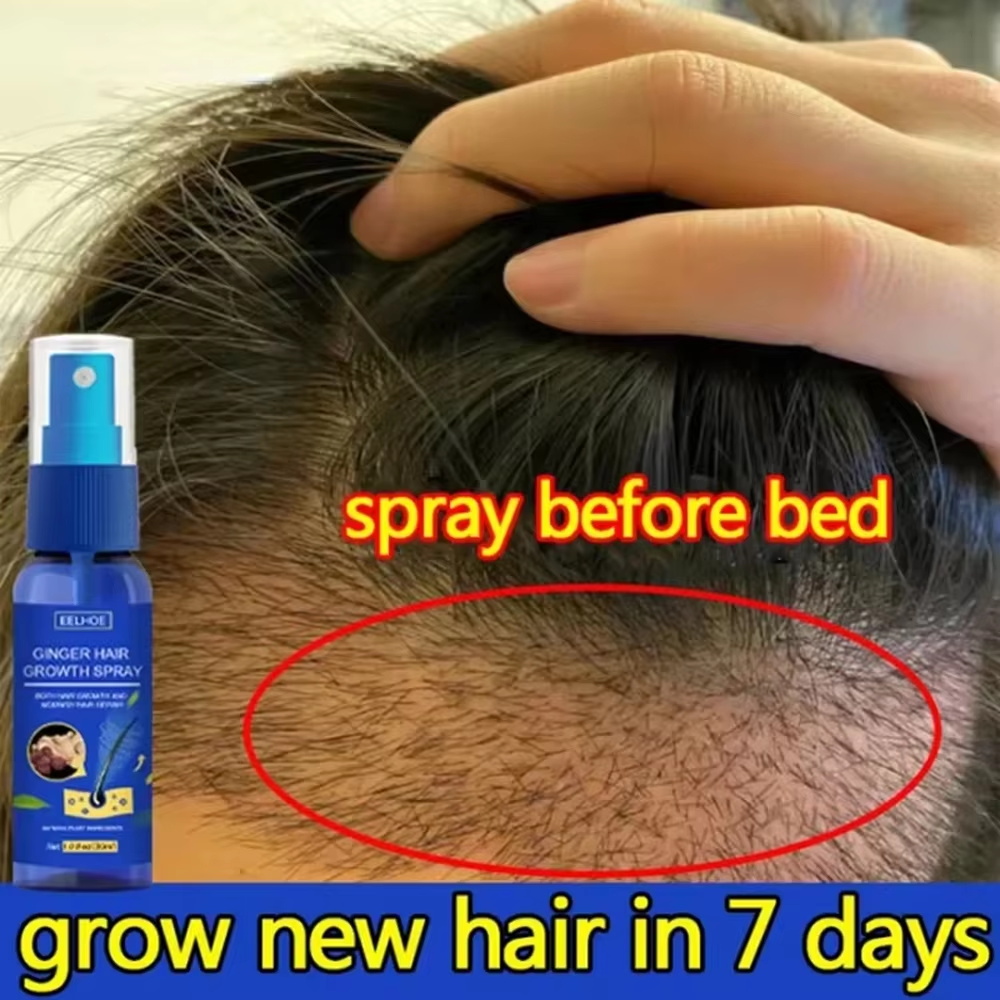 Fast Ginger Hair Growth Spray  - Hair Growth Serum Oil recension och pris